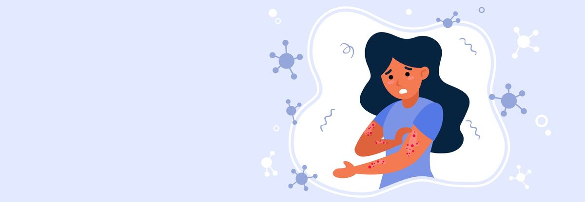 Allergies : causes, symptômes et traitement