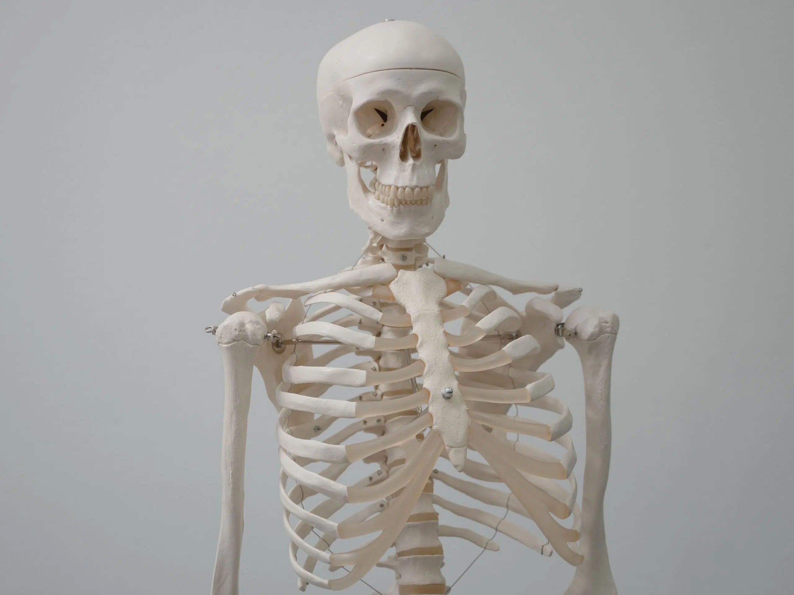 Osteoporosis: Kenali Gejala dan Cara Mencegah Tulang Keropos